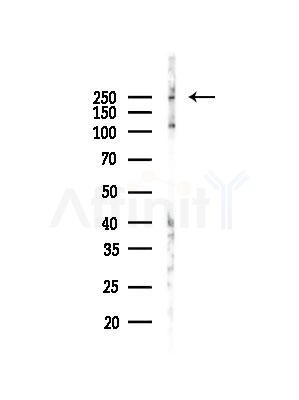Phospho-Desmoplakin (Ser165/Ser166) Antibody - Western blot analysis of lysates from A375 cells(heat-shock,45min treatment), using Phospho-Desmoplakin (Ser165/Ser166) Antibody at 1/1000 dilution.