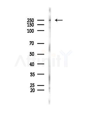 Phospho-Desmoplakin (Ser165/Ser166) Antibody - Western blot analysis of lysates from Rat brain, using Phospho-Desmoplakin (Ser165/Ser166) Antibody at 1/1000 dilution.