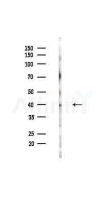Phospho-FRA1 (Ser265) Antibody - Western blot analysis of lysates from HUVEC cells(UV,30min treatment), using Phospho-FRA1 (Ser265) Antibody at 1/1000 dilution.