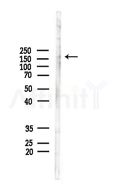 Phospho-Ras-GRF1 (Ser927) Antibody - Western blot analysis of lysates from 3T3-L1 cells(heat-shock,45min treatment), using Phospho-Ras-GRF1 (Ser927) Antibody at 1/1000 dilution.