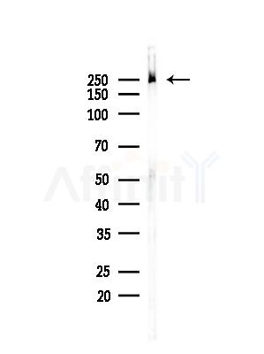 Phospho-CAD (Ser1859) Antibody - Western blot analysis of lysates from LoVo cells(heat-shock,45min treatment), using Phospho-CAD (Ser1859) Antibody at 1/1000 dilution.