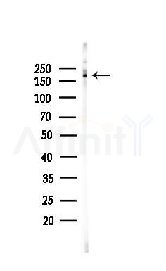 Phospho-IRS1 (Ser1101) Antibody - Western blot analysis of lysates from HUVEC cells, using Phospho-IRS1 (Ser1101) Antibody at 1/1000 dilution.