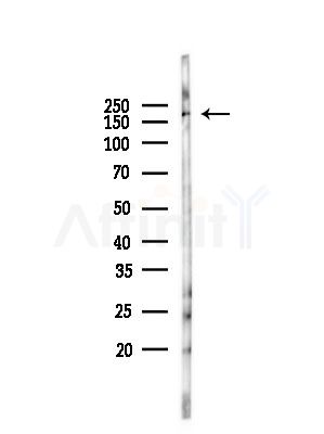 Phospho-MYH9 (Ser1943) Antibody - Western blot analysis of lysates from RAW264.