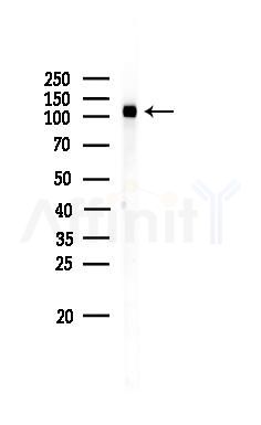 Phospho-Flt3 / CD135 (Tyr842) Antibody - Western blot analysis of lysates from EC304 cells, using Phospho-Flt3 / CD135 (Tyr842) Antibody at 1/1000 dilution.