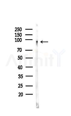 Phospho-TPOR (Tyr626) Antibody - Western blot analysis of lysates from HUVEC cells, using Phospho-TPOR (Tyr626) Antibody at 1/1000 dilution.