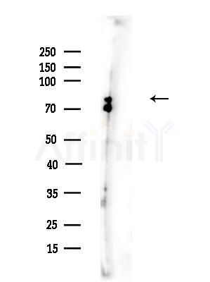 Phospho-NUMB (Ser276) Antibody - Western blot analysis of lysates from Mouse brain, using Phospho-NUMB (Ser276) Antibody at 1/1000 dilution.