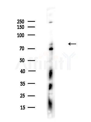 Phospho-NUMB (Ser276) Antibody - Western blot analysis of lysates from A375 cells(LPS,4h treatment), using Phospho-NUMB (Ser276) Antibody at 1/1000 dilution.