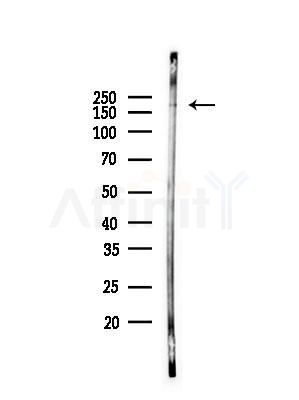 Phospho-Tuberin/TSC2 (Ser1387) Antibody - Western blot analysis of lysates from Hela cells(heat-shock,45min treatment), using Phospho-Tuberin/TSC2 (Ser1387) Antibody at 1/1000 dilution.