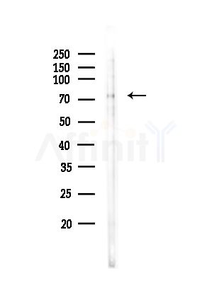 Phospho-IRAK1 (Thr100) Antibody - Western blot analysis of lysates from COLO205 cells(heat-shock,45min treatment), using Phospho-IRAK1 (Thr100) Antibody at 1/1000 dilution.