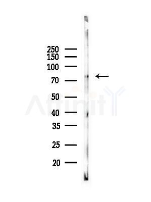 Phospho-IRAK1 (Thr209) Antibody - Western blot analysis of lysates from Hela cells(heat-shock,45min treatment), using Phospho-IRAK1 (Thr209) Antibody at 1/1000 dilution.
