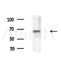Phospho-BMX (Tyr40) Antibody - Western blot analysis of extracts from various samples, using Phospho-BMX (Tyr40) Antibody at 1/1000 dilution.