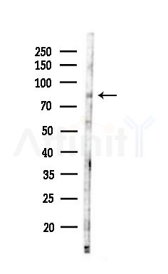 Phospho-BMX (Tyr40) Antibody - Western blot analysis of lysates from HepG2 cells(heat-shock,45min treatment), using Phospho-BMX (Tyr40) Antibody at 1/1000 dilution.