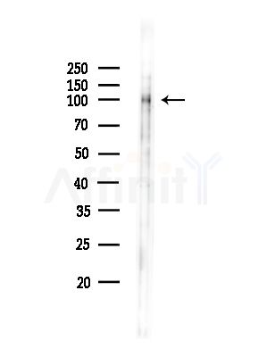 Phospho-Eg5 (Thr926) Antibody - Western blot analysis of lysates from COLO205 cells(heat-shock,45min treatment), using Phospho-Eg5 (Thr926) Antibody at 1/1000 dilution.