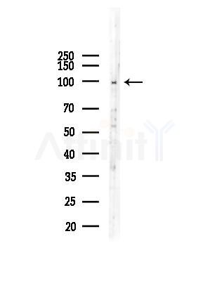 Phospho-VAV2 (Tyr142) Antibody - Western blot analysis of lysates from COLO205 cells, using Phospho-VAV2 (Tyr142) Antibody at 1/1000 dilution.