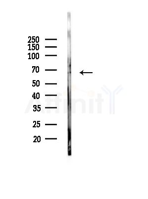 Phospho-MUNC-18a (Ser313) Antibody - Western blot analysis of lysates from A375 cells(heat-shock, 45min treatment), using Phospho-MUNC-18a (Ser313) Antibody at 1/1000 dilution.