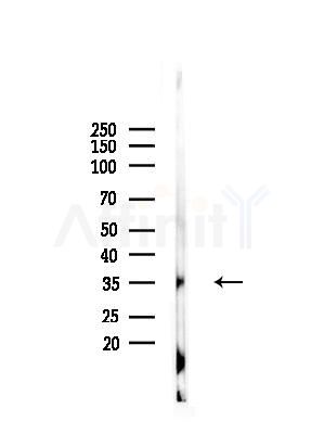 Phospho-PP2A-alpha (Tyr307) Antibody - Western blot analysis of lysates from RAW264.