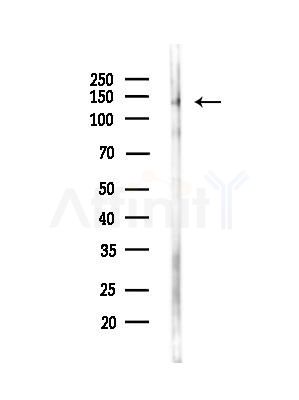 Phospho-PLC beta 3 (Ser537) Antibody - Western blot analysis of lysates from 293 cells(UV treatment), using Phospho-PLC beta 3 (Ser537) Antibody at 1/1000 dilution.