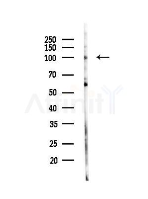 Phospho-FOXM1 (Ser35) Antibody - Western blot analysis of lysates from Hela cells(LPS,4h treatment), using Phospho-FOXM1 (Ser35) Antibody at 1/1000 dilution.