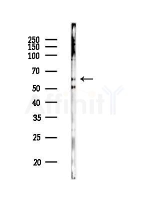 Phospho-PAK1 /PAK2 (Thr423/Thr402) Antibody - Western blot analysis of lysates from HUVEC cells(heat-shock, 45min treatment), using Phospho-PAK1 /PAK2 (Thr423/Thr402) Antibody at 1/1000 dilution.