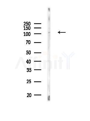 Phospho-PLD1 (Thr147) Antibody - Western blot analysis of lysates from MDA-MB-231 cells(heat-shock, 45min treatment), using Phospho-PLD1 (Thr147) Antibody at 1/1000 dilution.