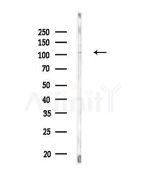 Phospho-PLD1 (Thr147) Antibody - Western blot analysis of lysates from MDA-MB-231 cells(heat-shock, 45min treatment), using Phospho-PLD1 (Thr147) Antibody at 1/1000 dilution.