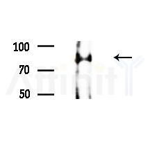 Phospho-RSK1 p90 (Thr573) Antibody - Western blot analysis of extracts from EC304 cells(heat-shock,45min treatment), using Phospho-RSK1 p90 (Thr573) Antibody at 1/1000 dilution.