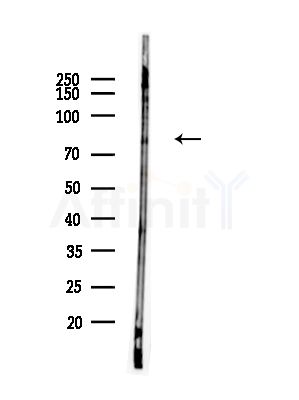 Phospho-RSK1 p90 (Thr573) Antibody - Western blot analysis of lysates from EC304 cells(heat-shock,45min treatment), using Phospho-RSK1 p90 (Thr573) Antibody at 1/1000 dilution.