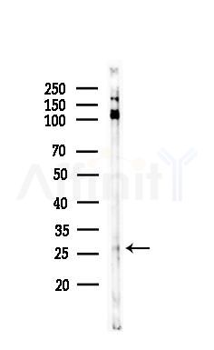 Phospho-MOB1A (Thr12)  Antibody - Western blot analysis of lysates from HUVEC cells, using Phospho-MOB1A (Thr12)  Antibody at 1/1000 dilution.