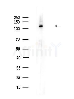 Phospho-GEF H1 (Ser886) Antibody - Western blot analysis of lysates from A375 cells(LPS,4h treatment), using Phospho-GEF H1 (Ser886) Antibody at 1/1000 dilution.