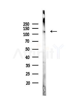 Phospho-SirT1 (Ser27) Antibody - Western blot analysis of lysates from Mouse brain, using Phospho-SirT1 (Ser27) Antibody at 1/1000 dilution.