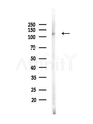 Phospho-SirT1 (Ser27) Antibody - Western blot analysis of lysates from 293 cells(UV treatment), using Phospho-SirT1 (Ser27) Antibody at 1/1000 dilution.