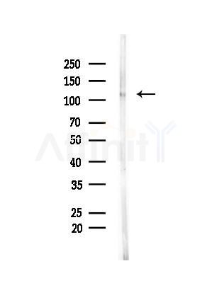 Phospho-SirT1 (Ser27) Antibody - Western blot analysis of lysates from Hela cells(LPS,4h treatment), using Phospho-SirT1 (Ser27) Antibody at 1/1000 dilution.