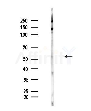 Phospho-Mnk1 (Thr250/Thr255) Antibody - Western blot analysis of lysates from Hela cells(UV,30min treatment), using Phospho-Mnk1 (Thr250/Thr255) Antibody at 1/1000 dilution.