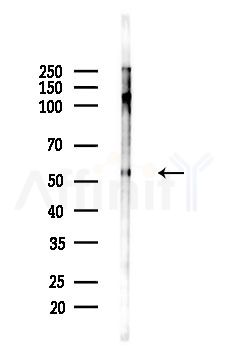 Phospho-Mnk1 (Thr250/Thr255) Antibody - Western blot analysis of lysates from Mouse brain, using Phospho-Mnk1 (Thr250/Thr255) Antibody at 1/1000 dilution.
