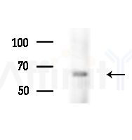 Phospho-CDCP1 (Tyr707) Antibody - Western blot analysis of extracts from various samples, using Phospho-CDCP1 (Tyr707) Antibody at 1/1000 dilution.