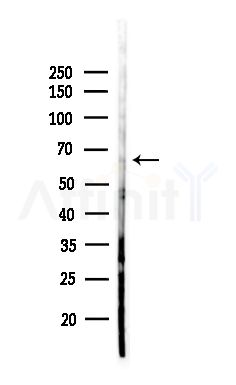 Phospho-CDCP1 (Tyr707) Antibody - Western blot analysis of lysates from HepG2 cells(heat-shock,45min treatment), using Phospho-CDCP1 (Tyr707) Antibody at 1/1000 dilution.