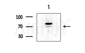 Phospho-ALK (Tyr1282/Tyr1283) Antibody - Western blot analysis of lysates from COLO205 cells, using Phospho-ALK (Tyr1282/Tyr1283) Antibody at 1/1000 dilution.