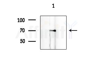 Phospho-ALK (Tyr1282/Tyr1283) Antibody - Western blot analysis of lysates from EC304 cells, using Phospho-ALK (Tyr1282/Tyr1283) Antibody at 1/1000 dilution.