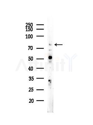 Phospho-ALK (Tyr1282/Tyr1283) Antibody - Western blot analysis of lysates from EC304 cells, using Phospho-ALK (Tyr1282/Tyr1283) Antibody at 1/1000 dilution.