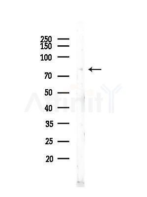 Phospho-ALK (Tyr1282/Tyr1283) Antibody - Western blot analysis of lysates from COLO205 cells, using Phospho-ALK (Tyr1282/Tyr1283) Antibody at 1/1000 dilution.