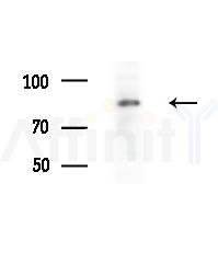 Phospho-Rabphilin 3A (Ser424) Antibody - Western blot analysis of extracts from various samples, using Phospho-Rabphilin 3A (Ser424) Antibody at 1/1000 dilution.