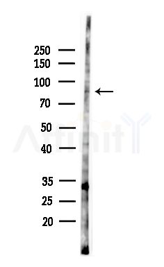 Phospho-Rabphilin 3A (Ser424) Antibody - Western blot analysis of lysates from HepG2 cells(heat-shock,45min treatment), using Phospho-Rabphilin 3A (Ser424) Antibody at 1/1000 dilution.