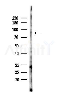 Phospho-Rabphilin 3A (Ser424) Antibody - Western blot analysis of lysates from HepG2 cells(heat-shock,45min treatment), using Phospho-Rabphilin 3A (Ser424) Antibody at 1/1000 dilution.