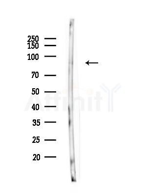 Phospho-TACC3 (Ser558) Antibody - Western blot analysis of lysates from Rat brain, using Phospho-TACC3 (Ser558) Antibody at 1/1000 dilution.