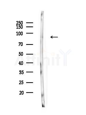 Phospho-TACC3 (Ser558) Antibody - Western blot analysis of lysates from Rat brain, using Phospho-TACC3 (Ser558) Antibody at 1/1000 dilution.