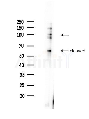 Phospho-ATF6 (Thr166) Antibody - Western blot analysis of lysates from Hela cells(heat-shock, 45min treatment), using Phospho-ATF6 (Thr166) Antibody at 1/1000 dilution.