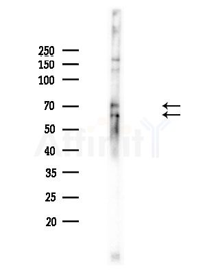Phospho-ATF6 (Thr166) Antibody - Western blot analysis of lysates from Mouse brain, using Phospho-ATF6 (Thr166) Antibody at 1/1000 dilution.