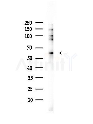 Phospho-ATF6 (Thr166) Antibody - Western blot analysis of lysates from Hela cells(heat-shock, 45min treatment), using Phospho-ATF6 (Thr166) Antibody at 1/1000 dilution.