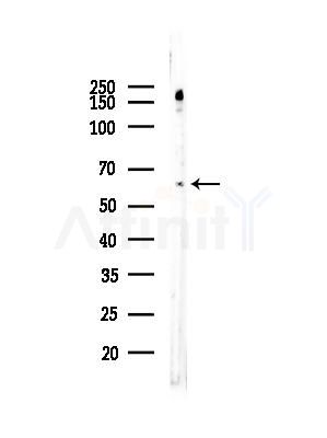 Phospho-RIPK3 (Ser316) Antibody - Western blot analysis of lysates from COLO205 cells, using Phospho-RIP3/RIPK3 (Ser316) Antibody at 1/1000 dilution.