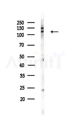 ASPP2 Antibody - Western blot analysis of lysates from COLO205 cells(UV,30min treatment), using ASPP2 Antibody at 1/1000 dilution.